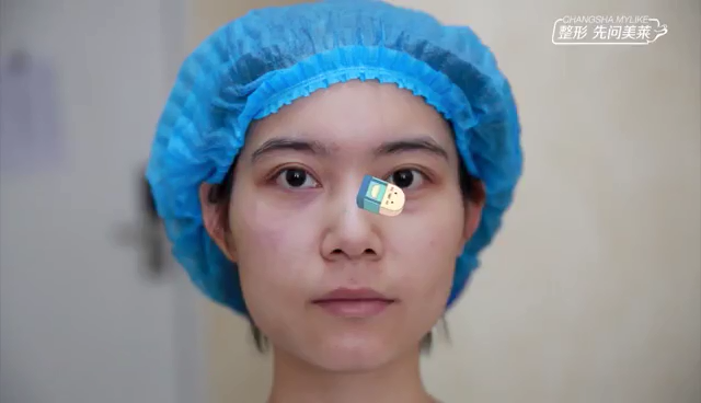 美萊眼周抗衰新品眼紋橡皮擦掃平眼紋，消除淚溝！