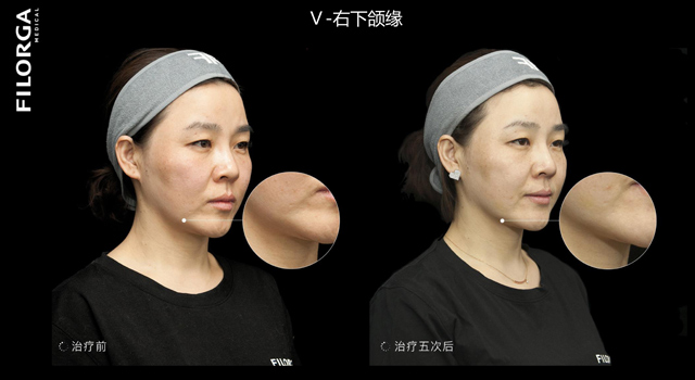 2018法國水光新品上市【免費(fèi)體驗(yàn)日】