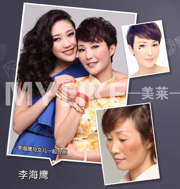 化妝品會讓黃褐斑增長嗎，預(yù)防黃褐斑有哪些方法