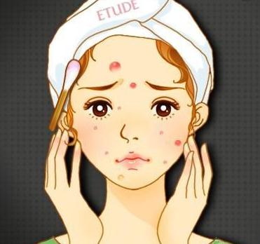 　　痘痘又叫青春痘，痤瘡，是毛囊皮脂腺單位的一種慢性炎癥性皮膚病。痤瘡的發(fā)生主要與皮脂分泌過(guò)多、毛囊皮脂腺導(dǎo)管堵塞、細(xì)菌感染和炎癥反應(yīng)等因素密切相關(guān)。長(zhǎng)痘痘的地方不僅僅是臉上，發(fā)際、背上、脖子等部位隨時(shí)都可能成為痘痘安家落戶的“家”。  　　那么，額頭上長(zhǎng)出了痘痘，又是什么原因呢?    　　研究表明，身體里長(zhǎng)痘痘往往和身體各器官有關(guān)。如果你的額頭總是長(zhǎng)痘痘，說(shuō)明你的肝臟已經(jīng)積累了過(guò)多， 不規(guī)律的生活、晝夜顛倒、長(zhǎng)時(shí)間熬夜都會(huì)讓肝臟不能在正常時(shí)間(夜里10點(diǎn)之后)工作，就會(huì)積累下來(lái); 心火過(guò)旺，脾氣不好，長(zhǎng)期思慮過(guò)度、勞心傷神的人，額頭上常常會(huì)長(zhǎng)出痘痘來(lái)。  　　額頭上長(zhǎng)了痘痘，我們又該怎么辦呢?  　　1.不要用手?jǐn)D!不要用手?jǐn)D!不要用手?jǐn)D!    　　重要的事情重復(fù)三遍。很多人會(huì)很不住用手?jǐn)D，這是一種錯(cuò)誤的方法。開(kāi)始，我們的手上有很多細(xì)菌，用指甲擠痘痘會(huì)把手上的細(xì)菌帶到皮膚里。其次，當(dāng)肌膚受到過(guò)大的外力時(shí)，皮膚組織會(huì)受到嚴(yán)重的損傷變形或產(chǎn)生淤血，甚至形成色素沉著形成痘疤痘坑。  　　2.保持良好的生活習(xí)慣  　　熬夜、晝夜顛倒會(huì)讓肝臟得不到休息，導(dǎo)致在肝臟累積。養(yǎng)成良好的生活習(xí)慣，早睡早起，有減少痘痘的爆發(fā)。  　　3.保持心情愉悅  　　遇到不愉快的事情，不要?jiǎng)硬粍?dòng)就大動(dòng)肝火，該看淡的就看淡，保持愉快的心情，心情好，人也會(huì)美美噠。  　　美萊醫(yī)學(xué)祛痘案例    　　4.發(fā)型不要遮住臉部  　　有的女生擔(dān)心額頭長(zhǎng)了痘痘會(huì)降低顏值，會(huì)用長(zhǎng)長(zhǎng)的劉海遮住額頭，不讓別人看到。這種方法是不對(duì)的。頭發(fā)上有油脂，搭在額頭上會(huì)引起痘痘的生長(zhǎng)。  　　5.不要過(guò)多攝入油炸食物、甜食巧克力、辛辣刺激類(lèi)食物    　　油炸型的食物聞起來(lái)香噴噴的，令人垂涎三尺，但吃多了不僅容易長(zhǎng)痘痘，還容易長(zhǎng)肉。為了潔凈的臉和苗條的身材，各位吃貨們還是多吃水果蔬菜，戒戒口吧。  　　　6.及時(shí)醫(yī)治。有的人認(rèn)為，青春期是痘痘生長(zhǎng)的主要時(shí)期，過(guò)了青春期就會(huì)消失了，不需要特別的治療的。這種觀念是錯(cuò)誤的。  　　青春期的結(jié)束并不代表著青春痘的結(jié)束，青春期過(guò)后青春痘還是會(huì)長(zhǎng)的。如果青春痘生長(zhǎng)過(guò)于頻繁影響到身體，可以采用科學(xué)醫(yī)美的方式——<a href='/km/' target='_blank'><u>昆明華美美萊</u></a>醫(yī)學(xué)祛痘治療的。  　　美萊醫(yī)學(xué)祛痘案例    　　美萊特別提示，選擇任何醫(yī)美項(xiàng)目一定要到正規(guī)整形美容醫(yī)院，向?qū)I(yè)醫(yī)師進(jìn)行詢問(wèn)，美萊醫(yī)師會(huì)根據(jù)您的個(gè)人情況，制定適合您的手術(shù)方案。這樣既有安全保障，又能防止手術(shù)效果。