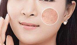 深圳做臉上激光祛斑多少錢(qián)呢