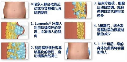 秋冬美麗不打折！讓美萊曹國靖醫(yī)師帶你一起【晶準(zhǔn)減脂 酷塑體線】