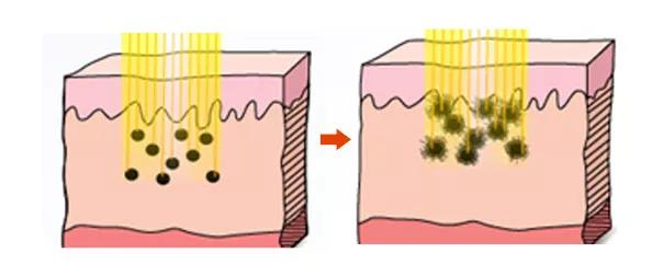 長斑和大姨媽有沒有關(guān)聯(lián)？