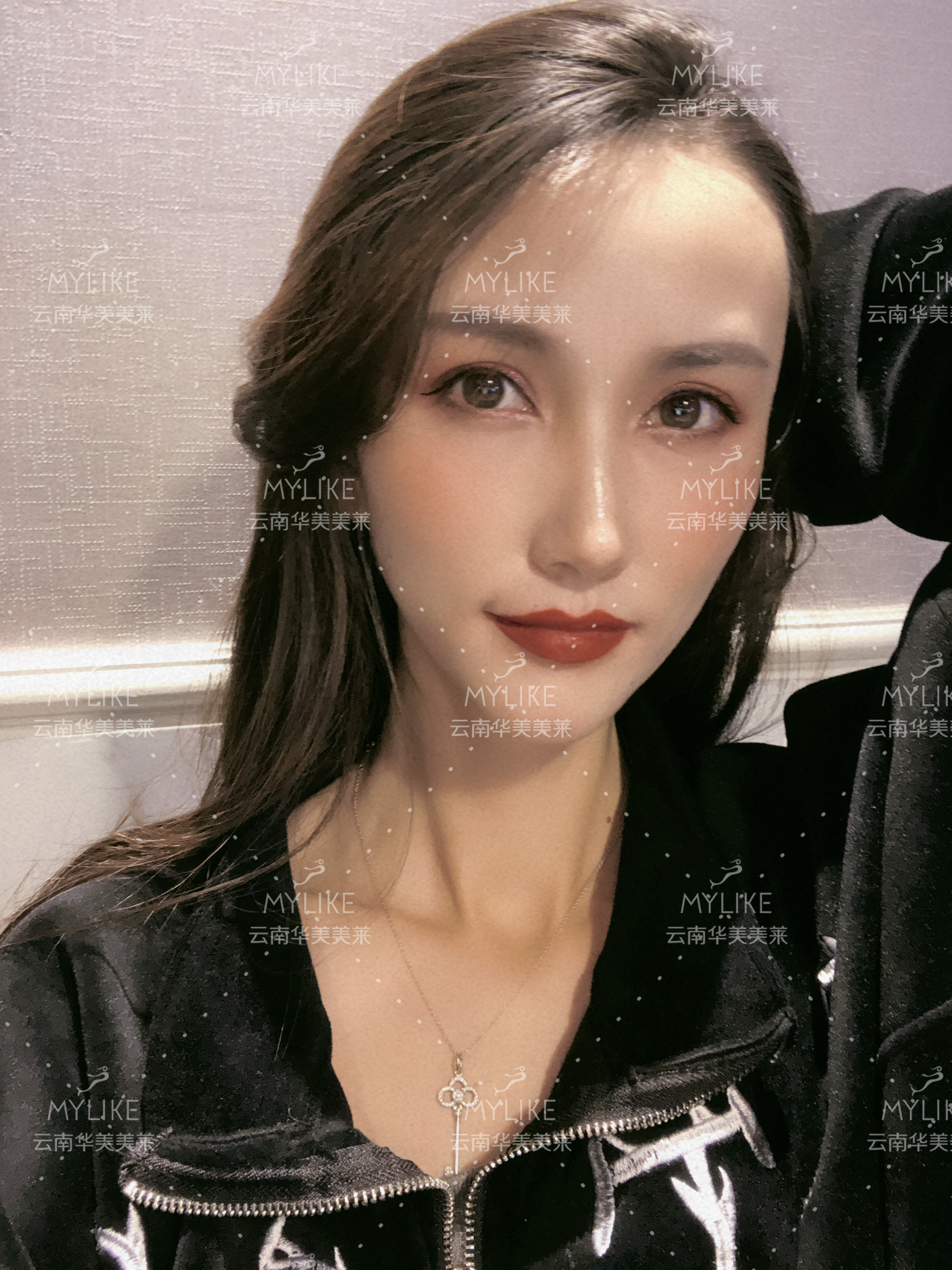 2018年“魅力絲路 時尚昆明”車模大賽勝者必要做的醫(yī)美項目?。∶廊R雙十一get好物推薦