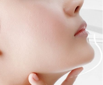 做假體墊下巴前有哪些準(zhǔn)備事項