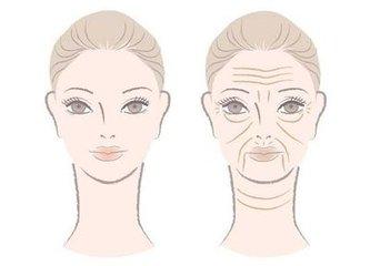 蘇州祛除眉間紋效果怎樣