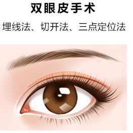 沈陽(yáng)做雙眼皮手術(shù)哪種類(lèi)型比較好