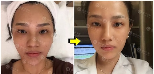 <a href='/cqhm/' target='_blank'><u>重慶華美</u></a>年終大促，直降9281