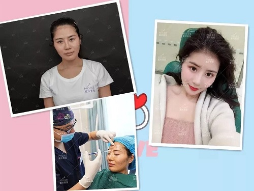 開搶丨重慶美萊多款項目2折起，玻尿酸、玻尿酸、抽脂針任性抽！