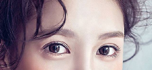 廈門(mén)埋線雙眼皮可以恢復(fù)原來(lái)嗎