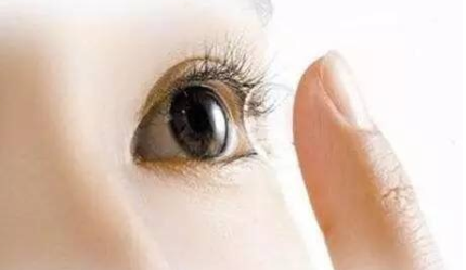 割雙眼皮會(huì)有難看的疤痕嗎