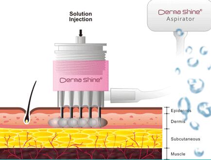 常州水光有什么優(yōu)勢嗎