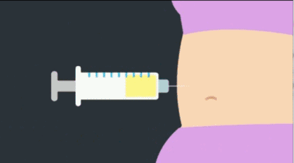 <a href='/sy/' target='_blank'><u>沈陽美萊</u></a>自體脂肪隆胸有哪些優(yōu)缺點(diǎn)！