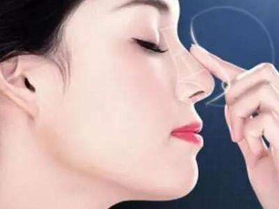 成都假體隆鼻的效果維持時間有多長？