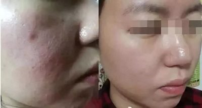 <a href='/sy/' target='_blank'><u>沈陽美萊</u></a>：嬰兒針是讓我的皮膚和嬰兒一樣白白嫩嫩？