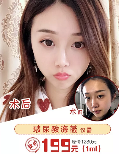 <a href='/fz/' target='_blank'><u>福州美萊</u></a>價(jià)值9.9水密碼、199玻尿酸拼團(tuán)開啟！