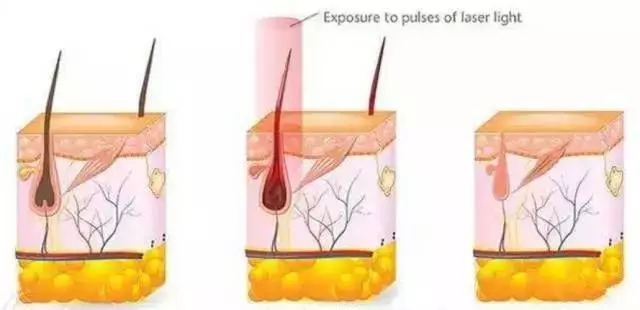 2019美萊萬人脫毛節(jié)?不負(fù)春光，任性脫！