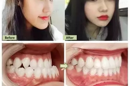 想要自信笑容，就來<a href='/suz/' target='_blank'><u>蘇州美萊</u></a>牙科