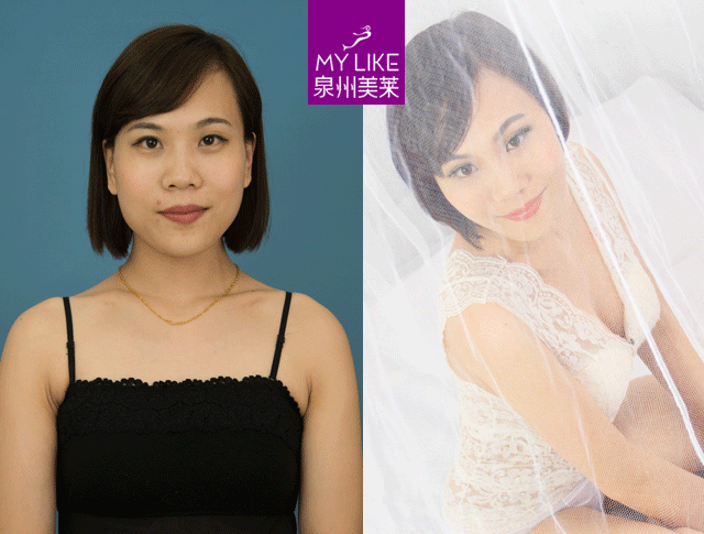 泉州美萊說(shuō)：喂完下一代，酥胸變布袋？怎么解決