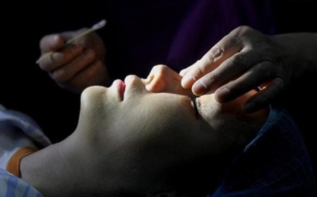 注射玻尿酸隆鼻多少錢(qián)