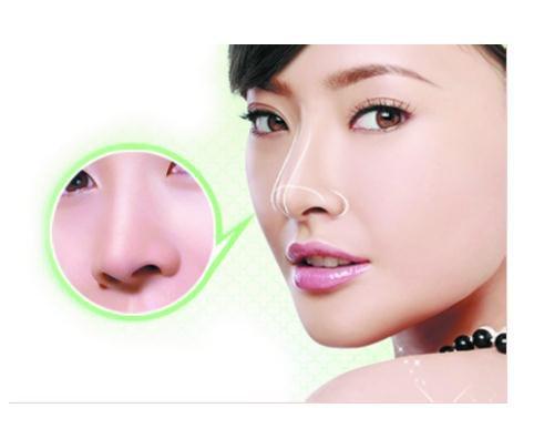 天津假體隆鼻可以保持一輩子嗎？