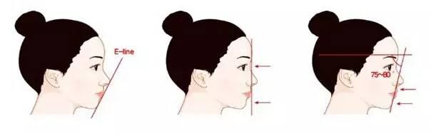 重慶做開眼角之后不能吃哪些東西？