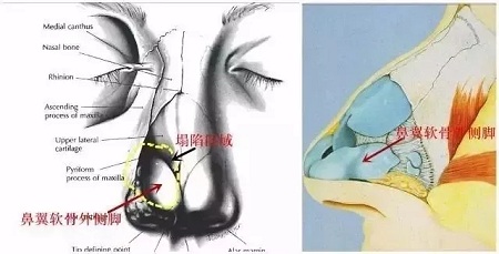 『雙側(cè)耳軟骨鏡像移植』男友“捏鼻殺”是什么感覺？