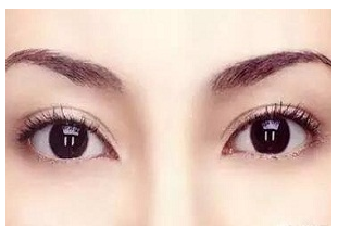 貴陽割雙眼皮后留疤是正?，F(xiàn)象嗎