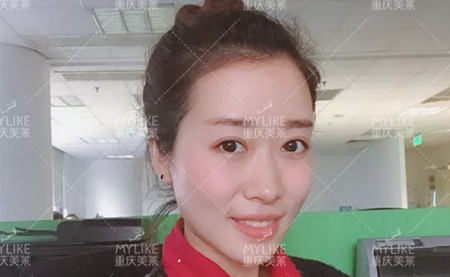 這里比皺紋更讓你顯老，你還不知道！