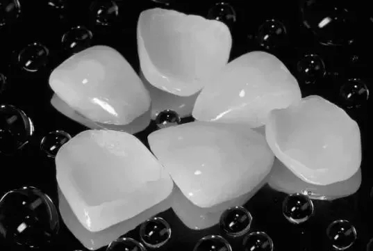 整天所說(shuō)的瓷貼面，究竟是什么？