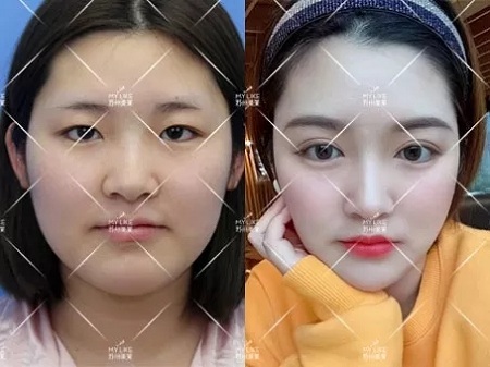 雙眼皮真的可以讓一部分人擁有神仙顏值！