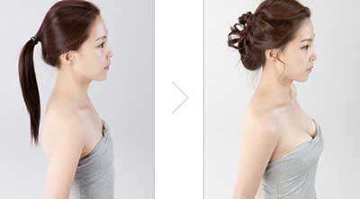 豐胸的辦法都有什么？