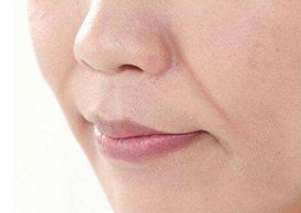 去法令紋有什么好辦法？