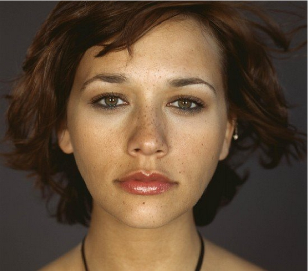 去斑比較有效的方法是什么？