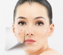 臉上長痘怎么辦？