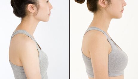 豐胸手術一般多少錢？