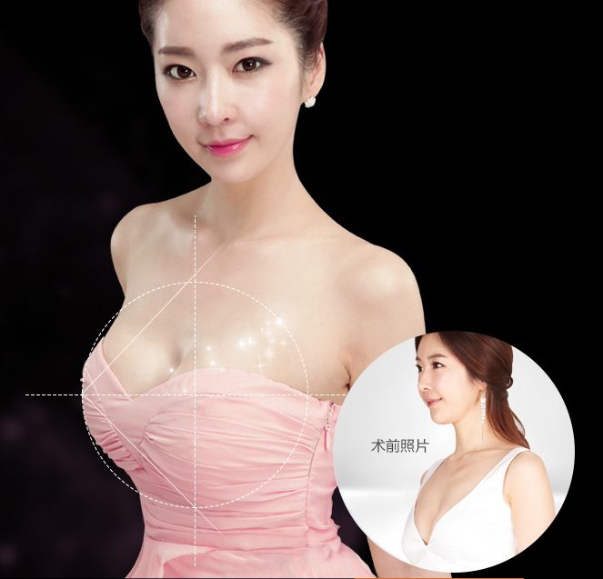 豐胸醫(yī)院怎么選？