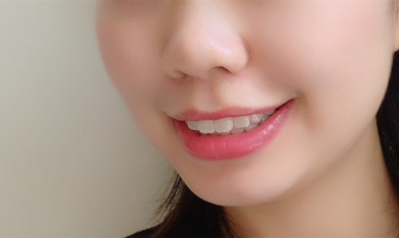 補(bǔ)一顆牙價(jià)格多少才算正常