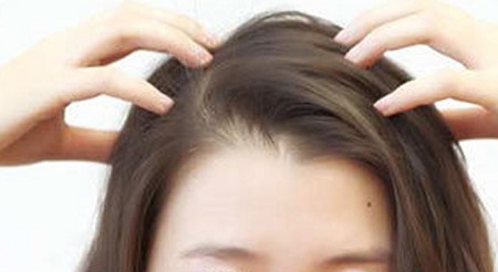 不做禿頭，掉發(fā)嚴(yán)重趕緊解決