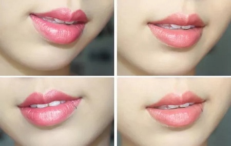 新年開運(yùn)整形塑造好面相，開啟豬年鴻運(yùn)之門！