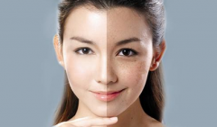 光子嫩膚價格是多少？