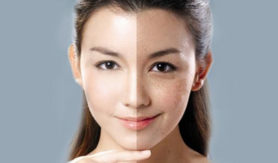 光子嫩膚價(jià)格是多少？