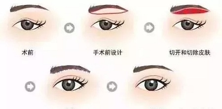 眼部衰老的三大“殺手”！