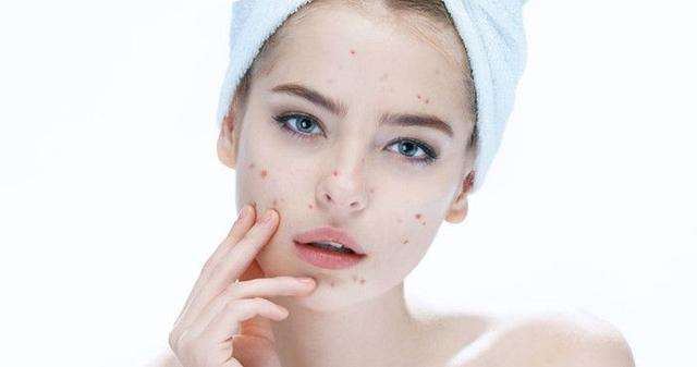 激光祛痘印真的不會損傷皮膚嗎？