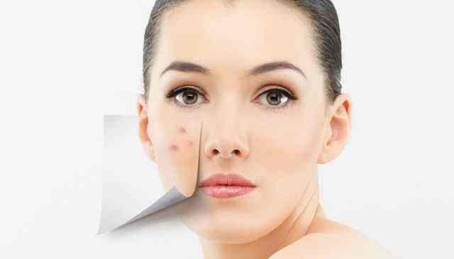 如何快速去除痘??？