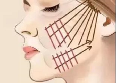 圍觀| 僅靠一條線，如何提升你的下垂臉？！