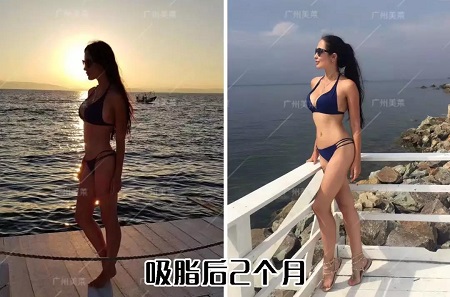 瘦腿很難嗎？1招教你變身筷子腿！