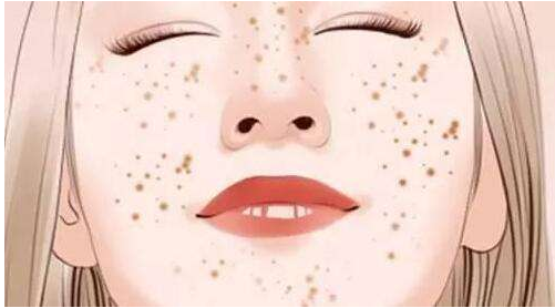 杭州激光祛斑有什么樣的優(yōu)勢呢？