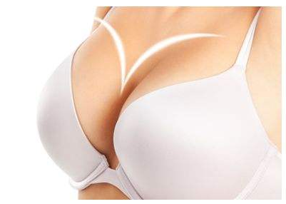 北京做假體隆胸恢復(fù)后的效果自然嗎？