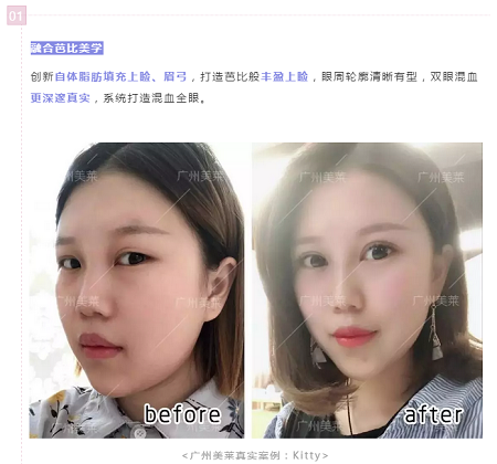 腫眼泡？重內(nèi)眥？學(xué)會這幾招，秒get混血美眼！